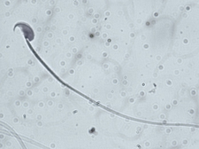 Sperm of a mouse